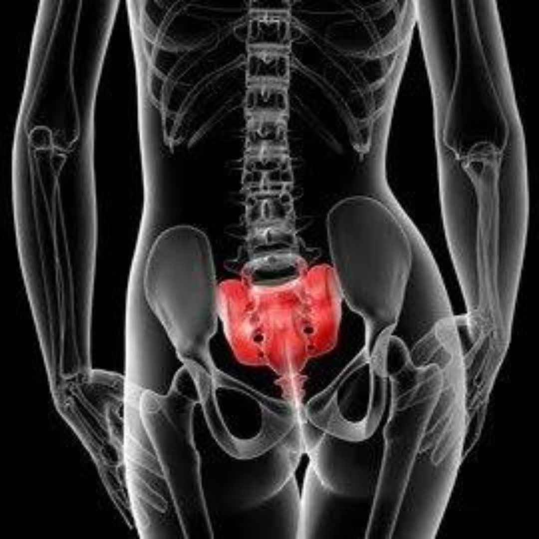 SI Joint Dysfunction