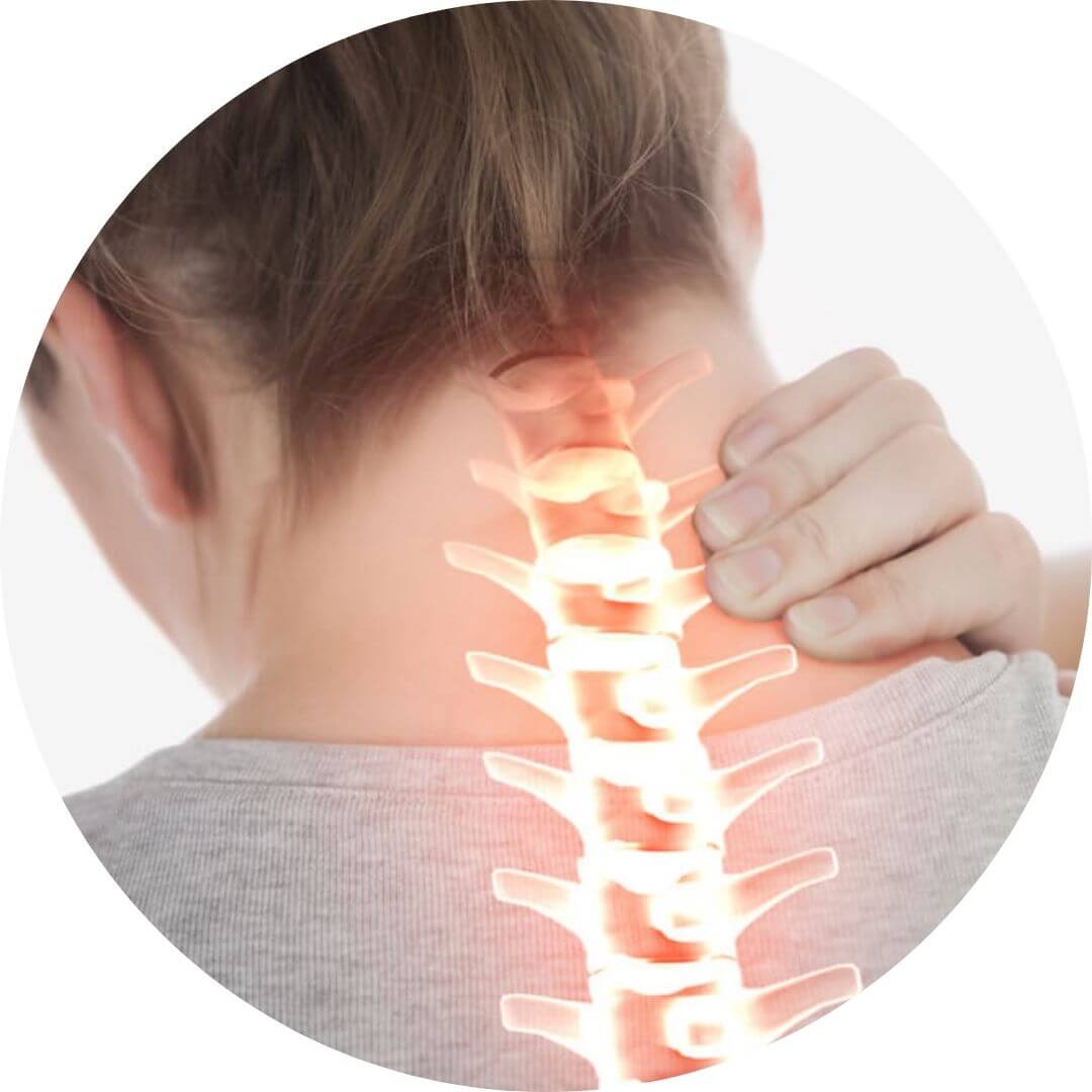 Cervical Spondylosis