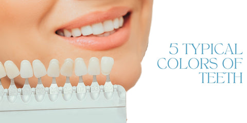 5 TYPICAL COLORS OF TEETH