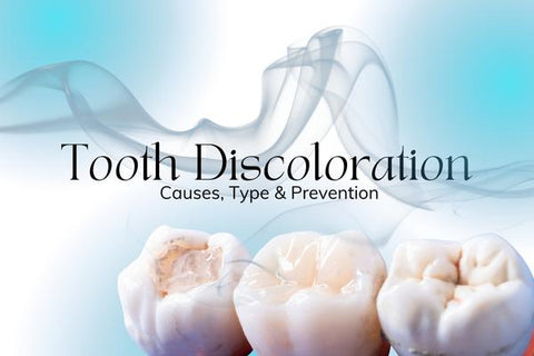 Decoloración de los dientes
