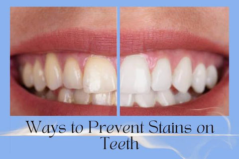 Ways to Prevent Stains on Teeth