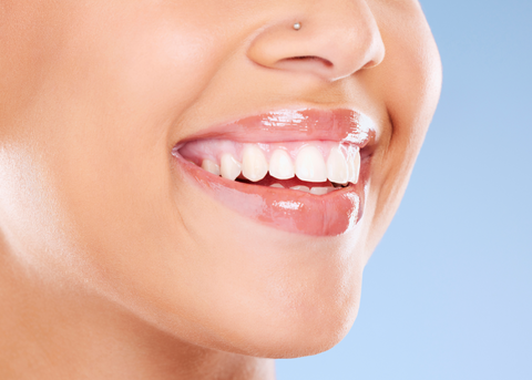 mujer sonriendo con dientes blanqueadores