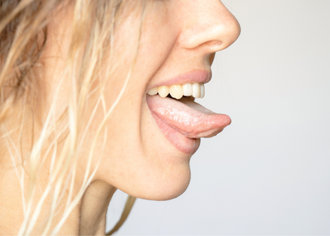 A woman who did Oral Piercings showing her Dental Health