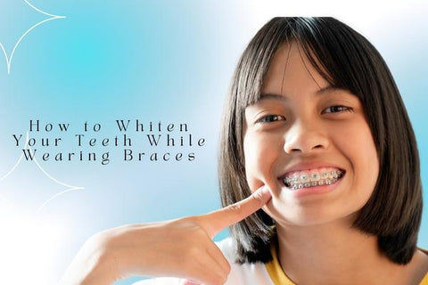 Cómo blanquear los dientes mientras usas frenillos
