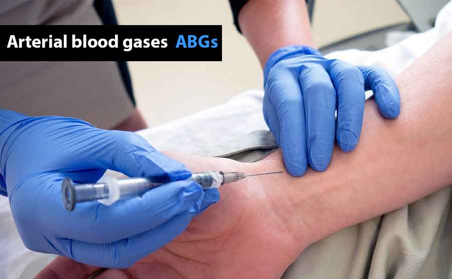 Arterial blood gases