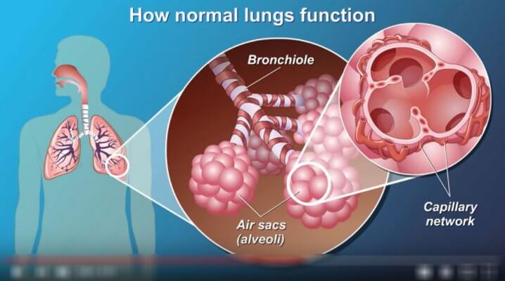 Understanding COPD and how medical oxygen can help