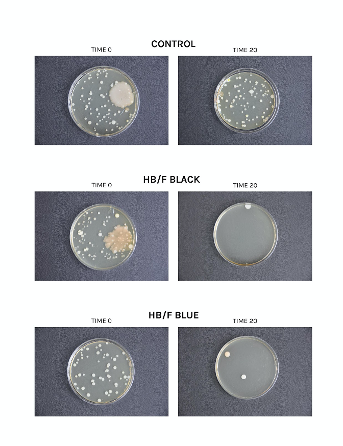 bacteria growth agar plate 