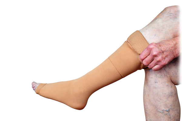 Person With Varicose Vein Wearing Compression Socks In Knee High Beige