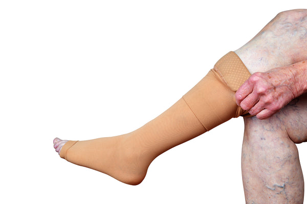Women With Varicose Veins In The Legs Wearing Compression Socks