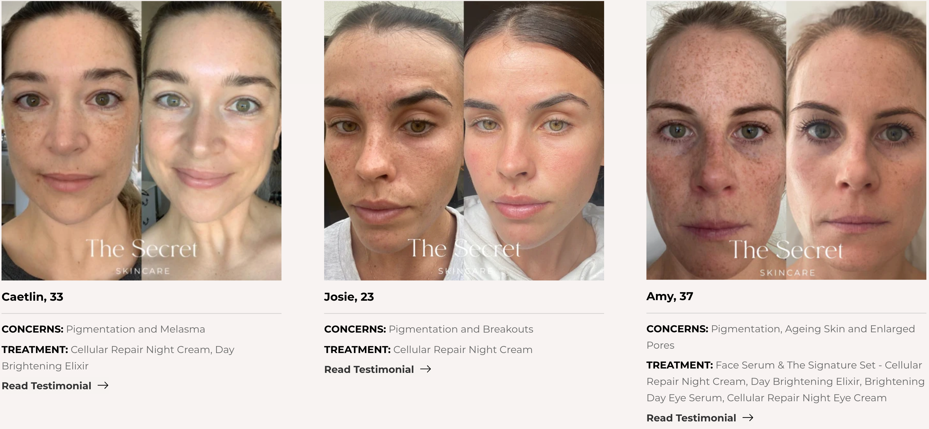 Real results from The Secret Skincare to combat pigmentation