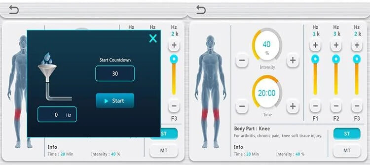 Physio magneto screen looks