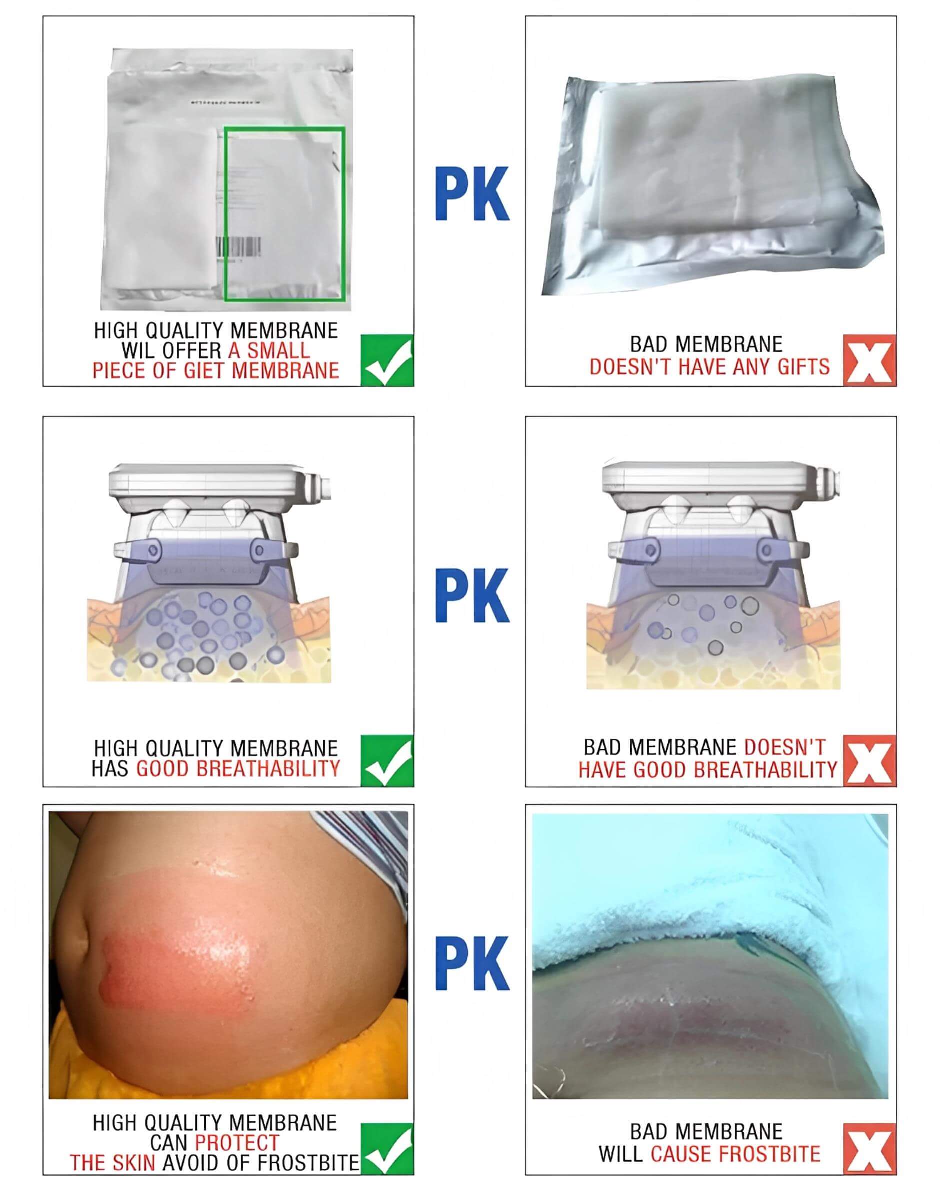 Back Body Shaper Anti Freezing Membrane For Cryolipolysis, For Clinical  Purpose at Rs 200/piece in Noida