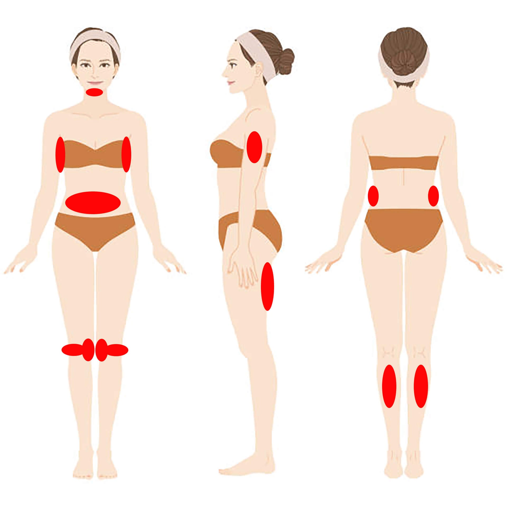 Treatment Areas of Cryo Slimming Machine