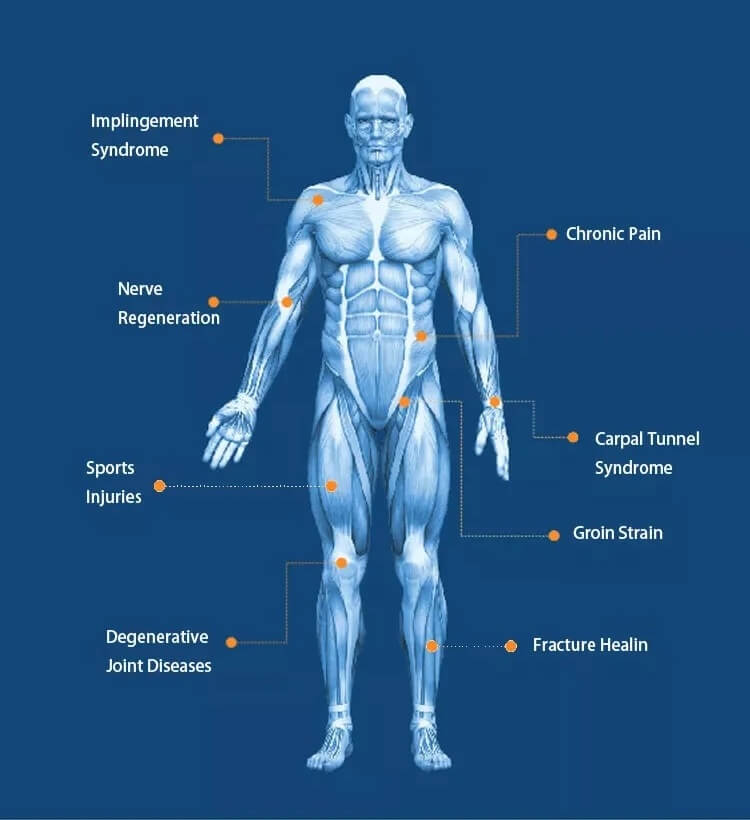 Magnetotherapy device treatment areas