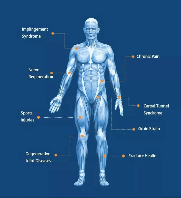 Áreas de tratamiento con dispositivos de magnetoterapia.