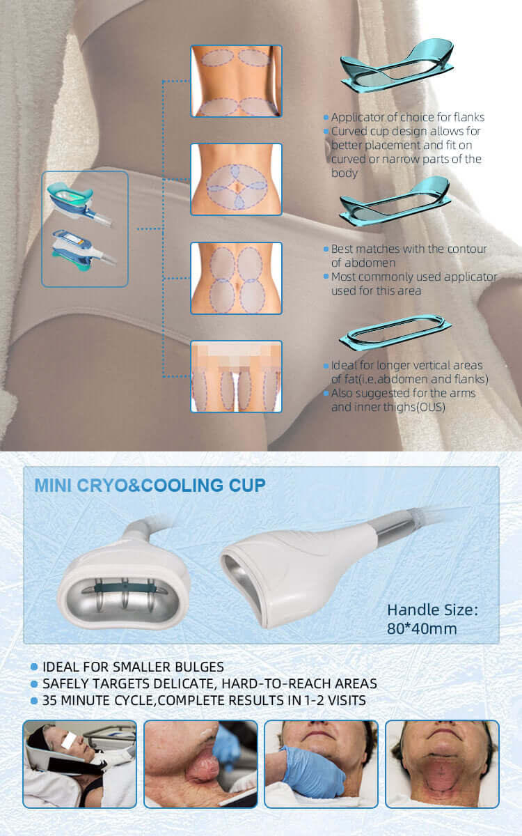 Mini Cooling Handle of Cryo Slimming Machine