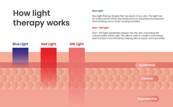 How light therapy works