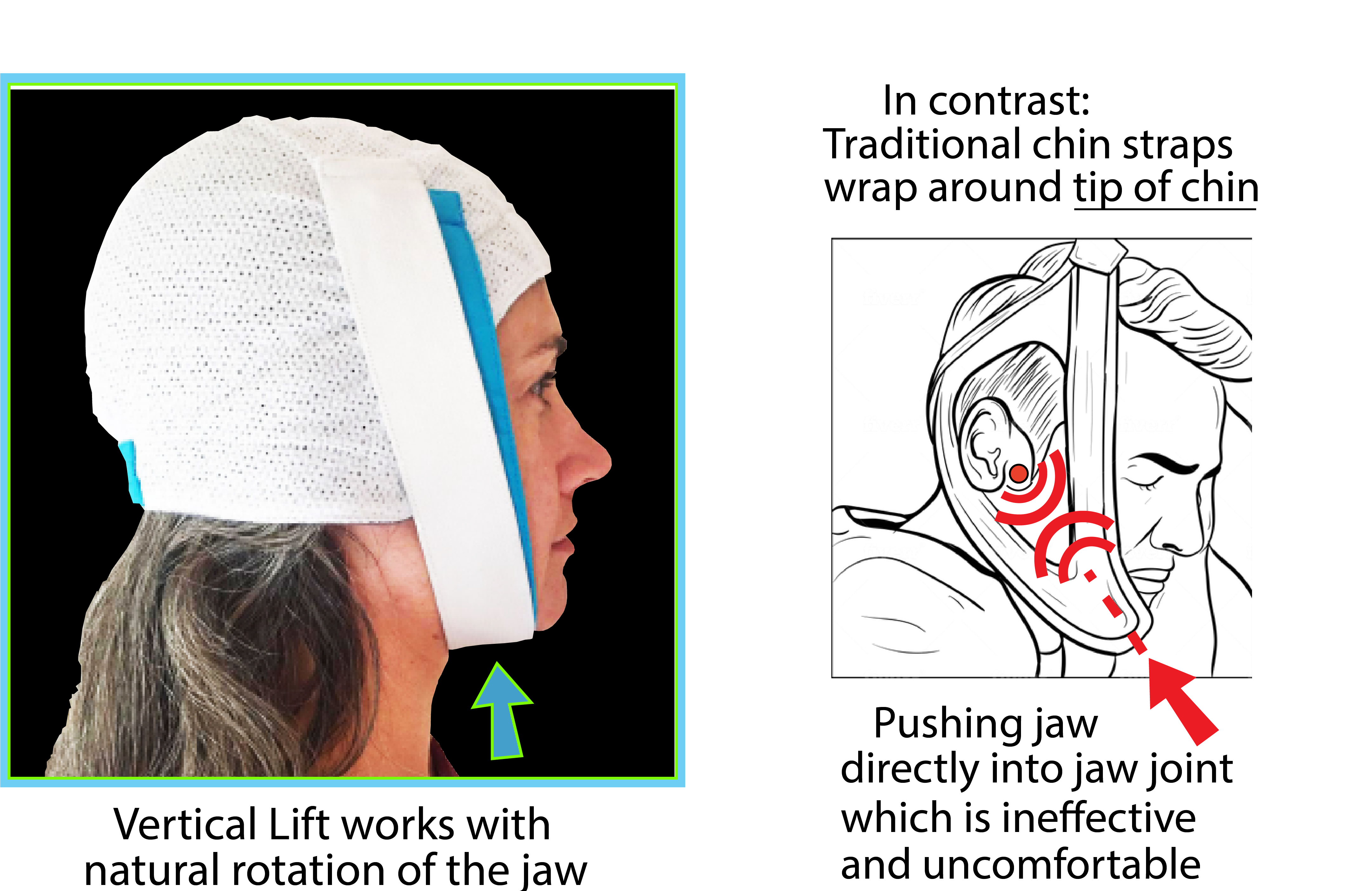 Best snoring chin strap