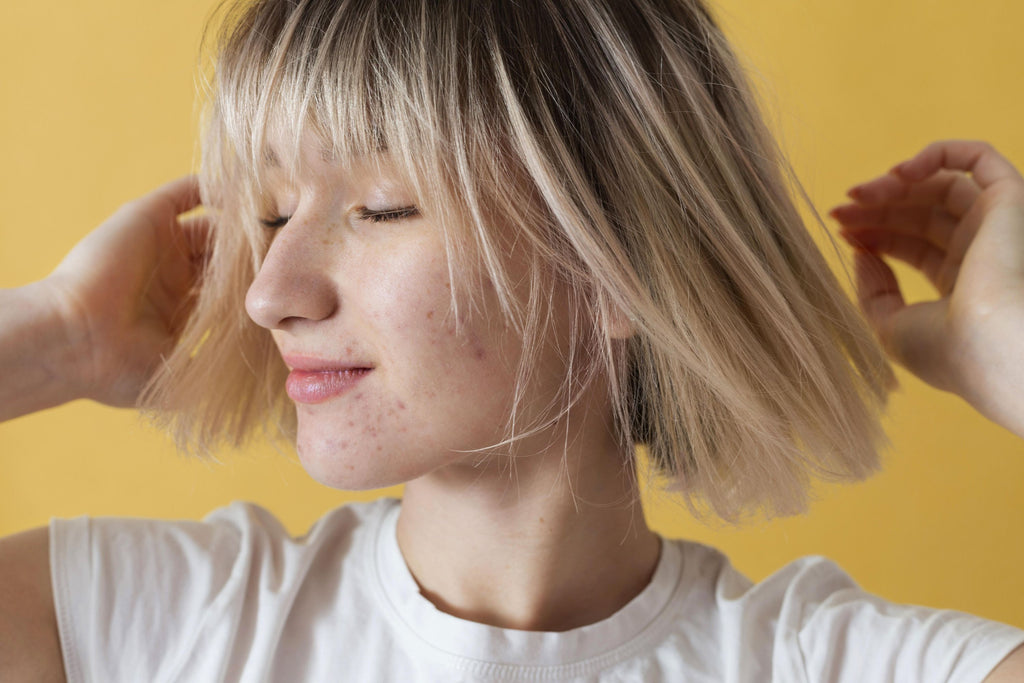 Incorporar la niacinamida con conocimiento y precaución te permitirá disfrutar de sus beneficios, minimizando el riesgo de irritación, especialmente crucial para aquellos con rosácea.