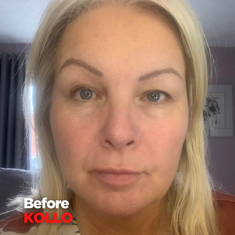 Fiona's Customer Journey - Before Kollo