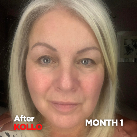 Fiona's Customer Journey - After 1 month of Kollo