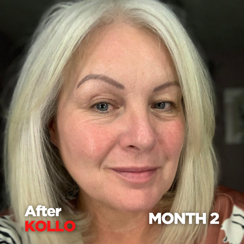 Fiona's Customer Journey - After 2 months of Kollo