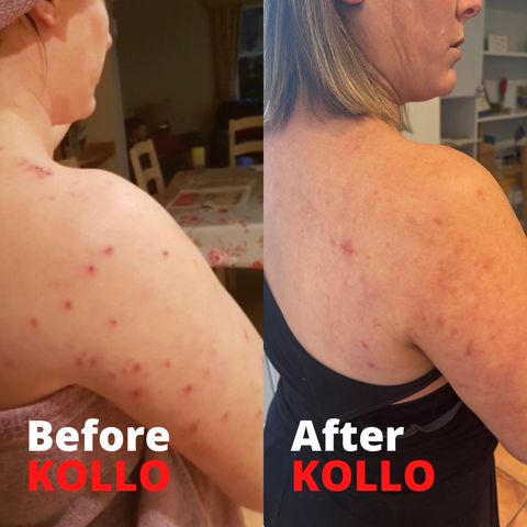 Helen before and after Kollo