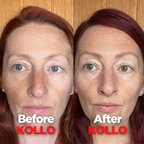 Before and After Kollo: Rachel