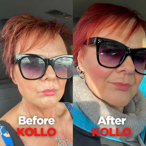 My Kollo Journey - Shany