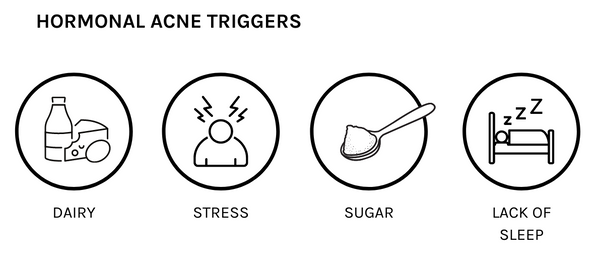 Dairy, stress, sugar and lack of sleep are 4 things that can trigger hormonal acne
