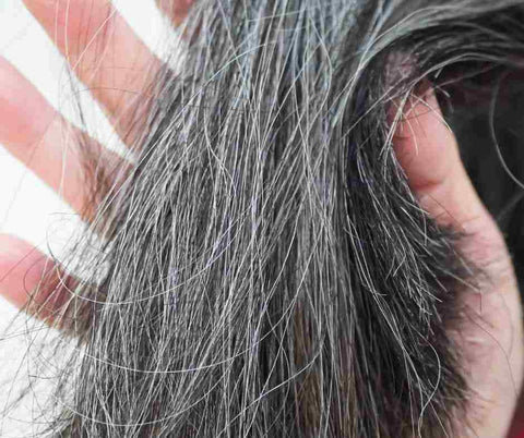 premature grey hair