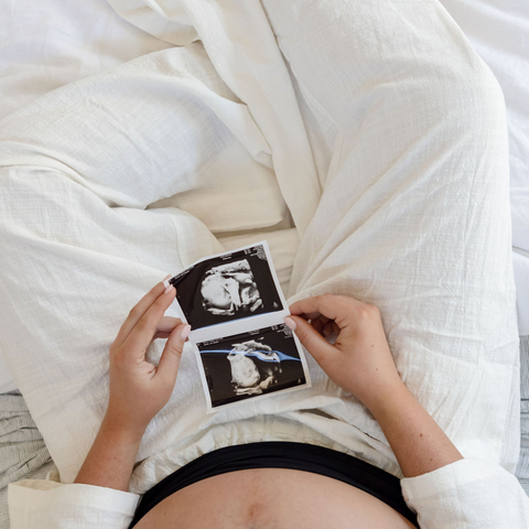 An overview of a pregnant woman’s lap. She is sitting up on a bed and looking at ultrasound pictures of her unborn baby, preparing for birth.