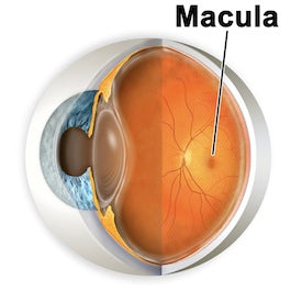3D eye showing macular degeneration