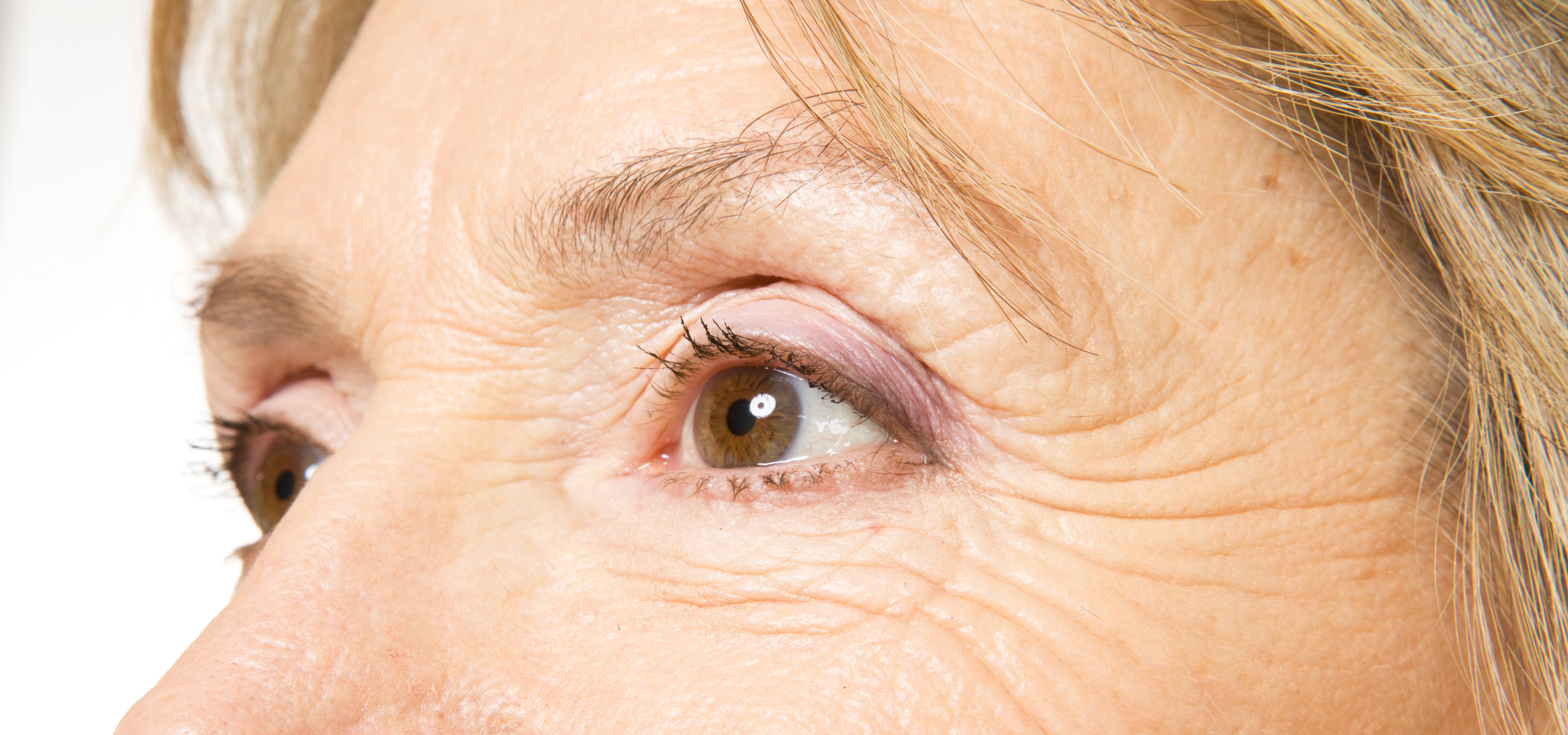 aging eyelids