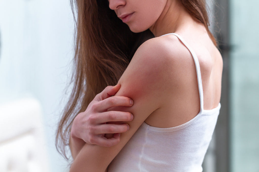 Skin conditions Psoriasis