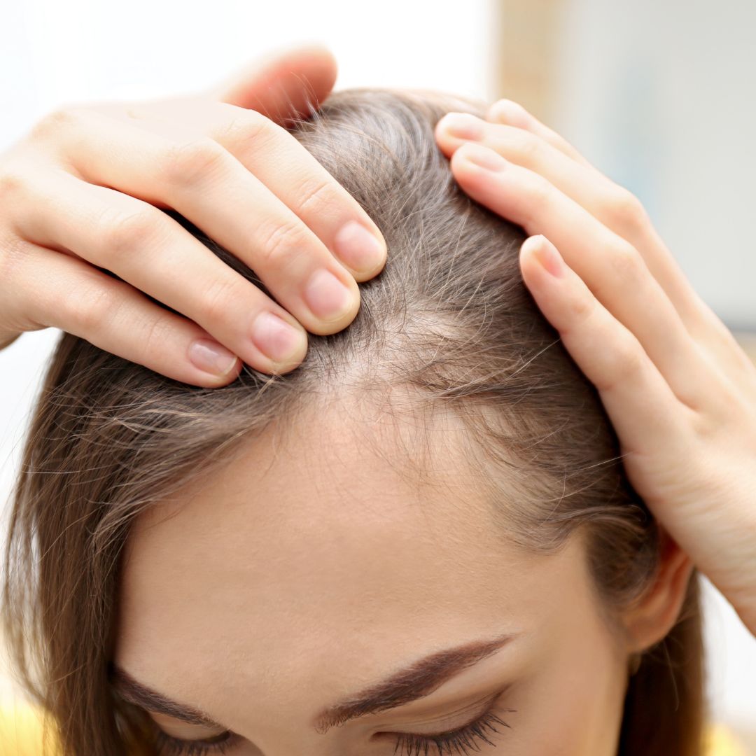 Main Causes of Hair Loss in Women