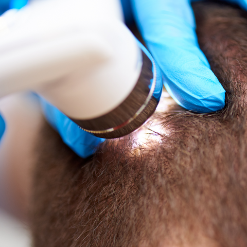 A closeup of a hair examination by a trichologist.