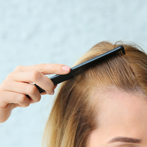 Close-up photo of a woman brushing her hair and showing a receding hairline.
