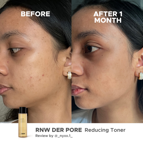 rnw-pore-reducing-toner