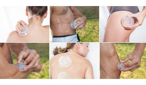 cupping therapy, cupping, cupping massage, cupping set, chinese cupping massage cupping, benefits of cupping, what is cupping, does cupping work