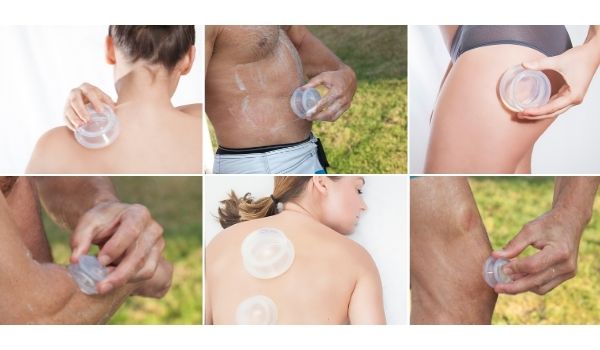 self care cupping, diy cupping, beginner cupping, silicone cupping, cupping, cupping therapy, what is cupping therapy, cupping massage