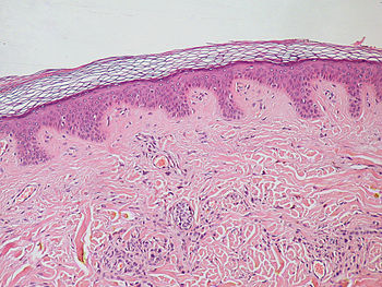 the structure of rete ridges in our skin