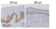 structure of rete ridges in our skin in our early 20s and at 80 years old