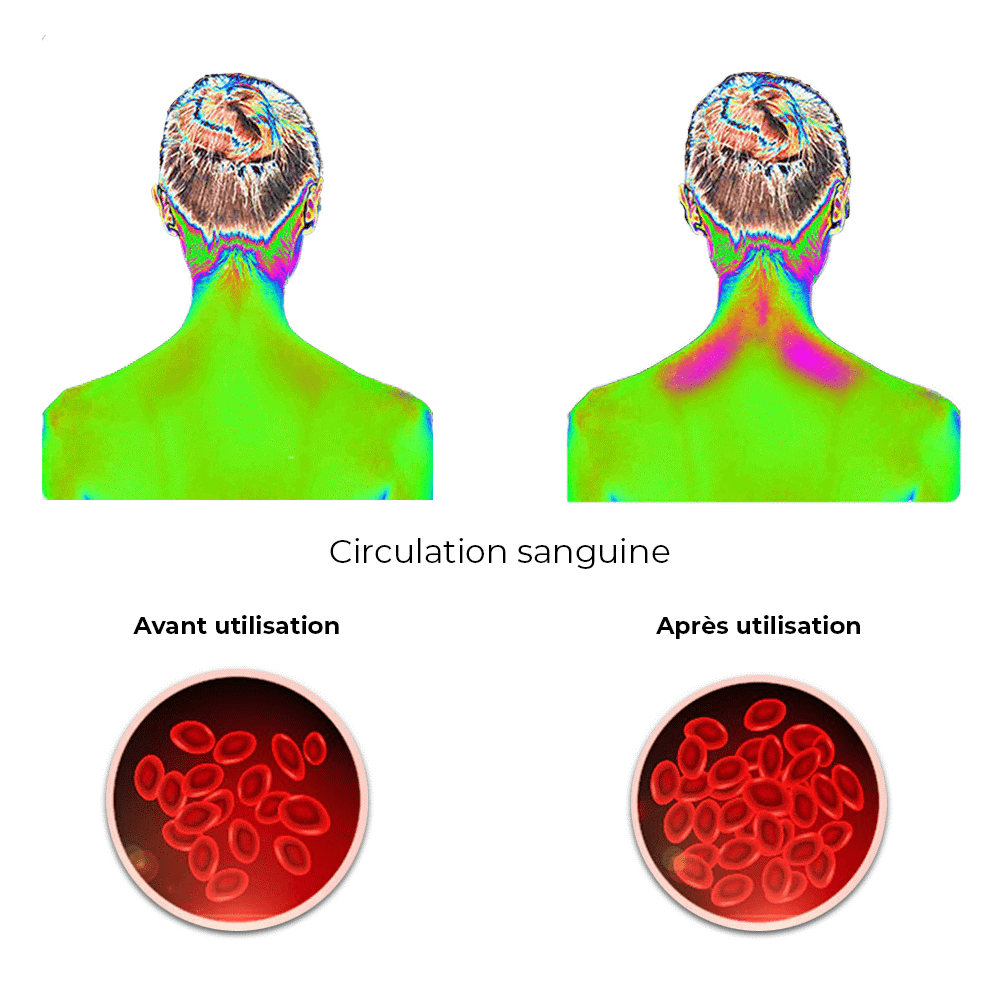 stimulateur circulation sanguine 