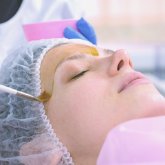 Image of a woman getting a chemical peel