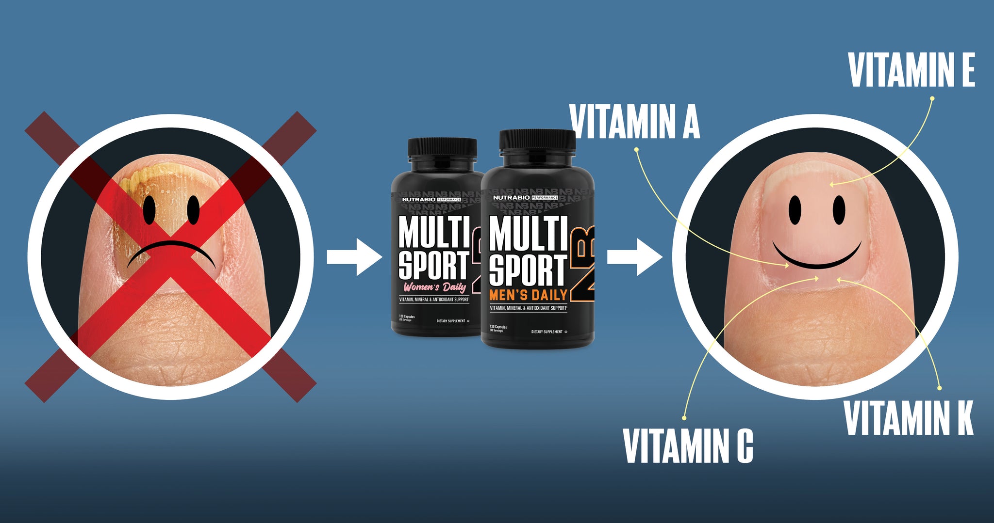 Support nail health with multi-sport