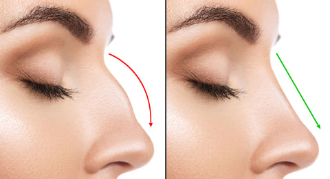 non surgical nose job