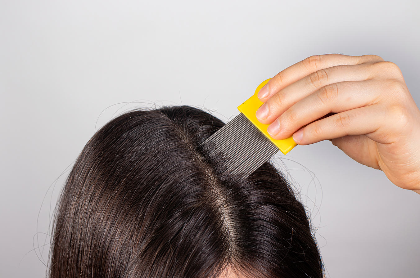 10 Reasons Your Scalp Might Be Itchy  And What to Do About It  Scalp  Conditions Treatments