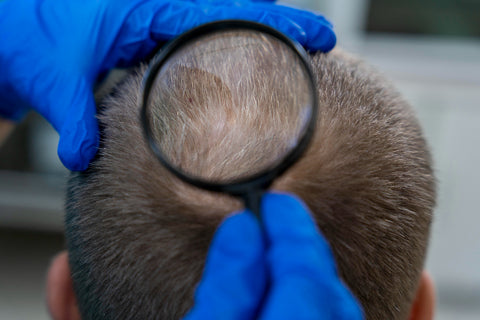 Factors Affecting How Often You Should Do Scalp Treatments