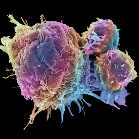 Image of a T-cell.